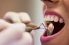 U potrazi za zdravim osmijehom: otkrijte GLAVNE rizike za vaše oralno zdravlje