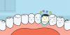Hvordan heler tænderne? En videnskabelig artikel for nysgerrige unge