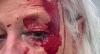 Kobieta zostaje zaatakowana przez mewę na jej progu w Walii; zrozumieć sprawę