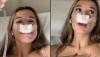 Mum Gets Rhinoplasty Hoping Kids Will 'Inherit' Attractive Nose